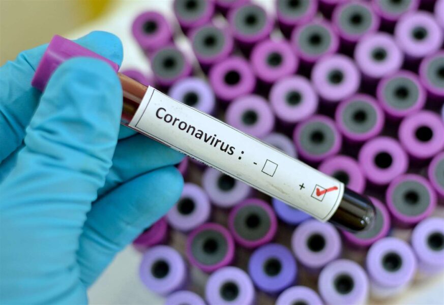 Estudo mostra que coronavírus já circulava no Brasil antes do isolamento