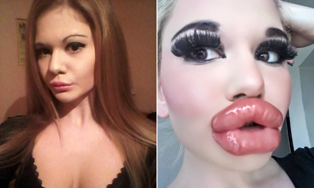  barbie humana antes e depois