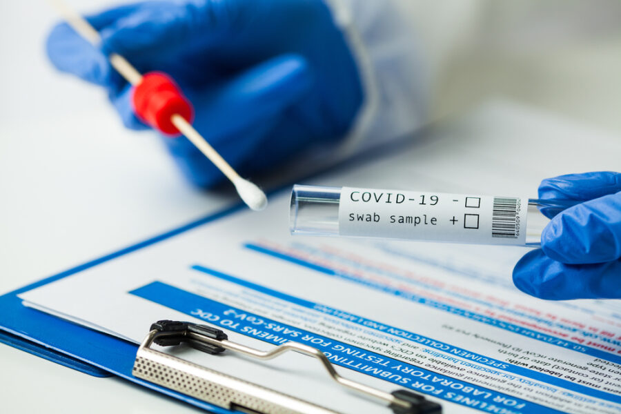 Exame Coronavírus: laboratório em Curitiba e Maringá inova na testagem