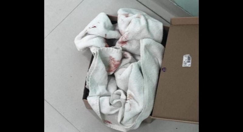 Catador encontra bebê recém nascida abandonada em caixa de sapato dentro de lixeira