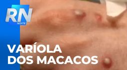 Secretaria de Saúde do Paraná monitora casos suspeitos de varíola dos macacos