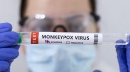 Cascavel confirma o 1° caso de varíola dos macacos