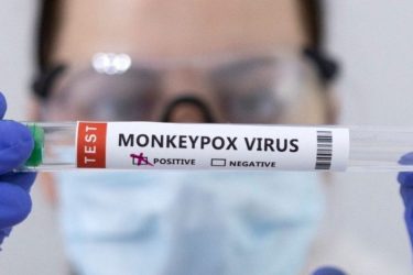Primeiro caso suspeito de varíola dos macacos é monitorado em Cascavel