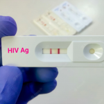 Londrina amplia testes rápidos de sífilis, HIV e hepatite B e C para gestantes