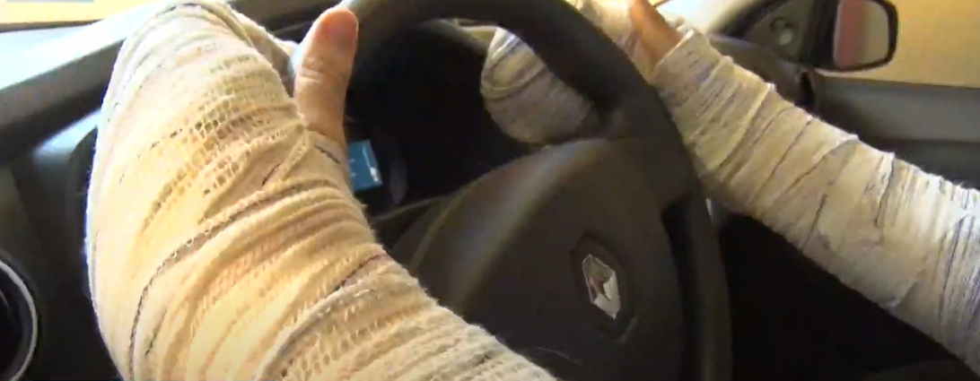 Motorista de aplicativo perde movimento das mãos após assalto, em Londrina