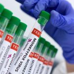 Brasil ultrapassa a marca de 3 mil casos de varíola do macaco em 10 semanas