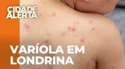 Londrina confirma primeiro caso da varíola do macaco; 52 casos no PR